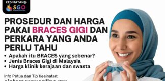 Prosedur dan Harga Pakai Braces Gigi dan Perkara yang Anda Perlu Tahu BRACES GIGI