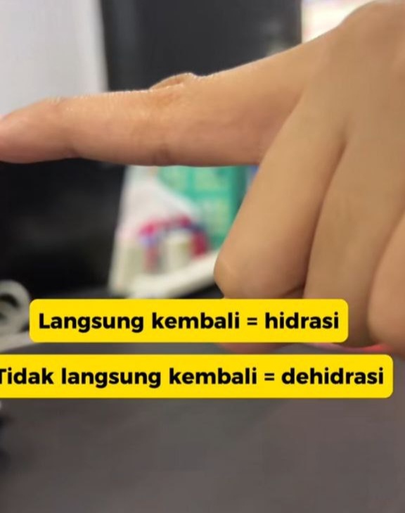 Tanda-Tanda Dehidrasi dan 3 Langkah Kenalpasti Dehidrasi Dengan Pantas 4 IMG 20231207 125725 404