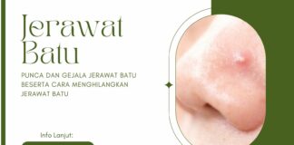 5 Punca dan Gejala Jerawat Batu Beserta Cara Menghilangkan Jerawat Batu 5 Punca dan Gejala Jerawat Batu Beserta Cara Menghilangkan Jerawat Batu