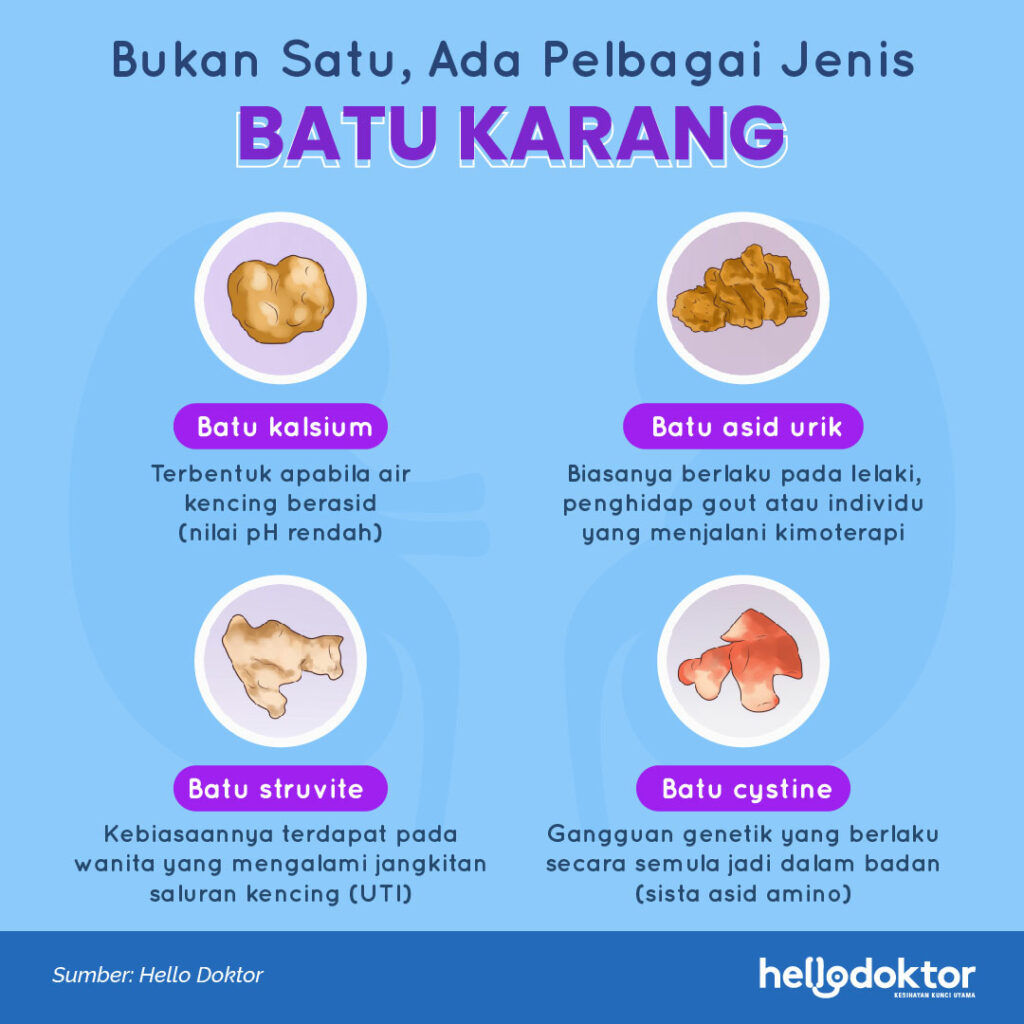 9 Tanda-tanda Penyakit Batu Karang dan Cara Buang Batu Karang Tanpa Pembedahan 2 259352078 2848475452079642 3723412765582716974 n