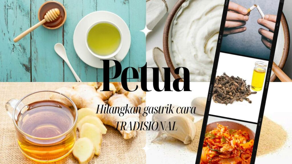 Cara Atasi Gastrik Angin dan Doa Hilangkan Gastrik 3 Cara Atasi Gastrik