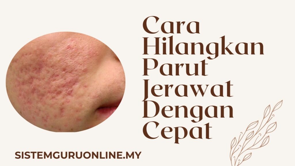 Parut jerawat