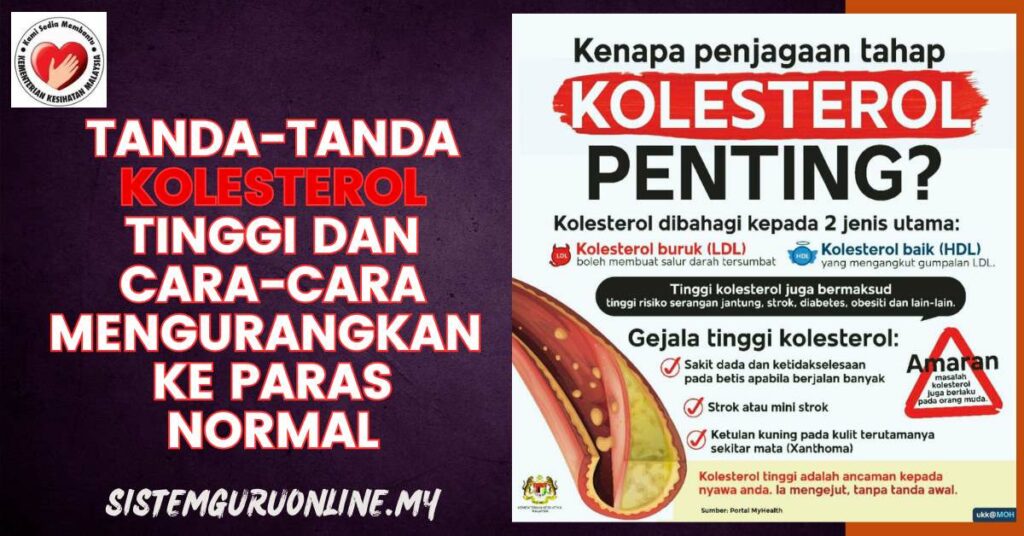 tanda kolesterol tinggi