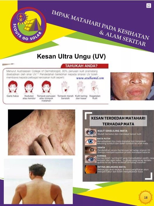 Kesan Bahaya UV Pada Kesihatan tutup sekolah uv tinggi