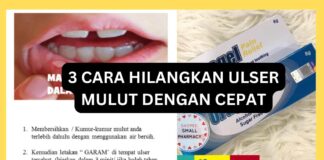 3 Cara Hilangkan Ulser Mulut Dengan Cepat 3 Cara Hilangkan Ulser Mulut Dengan Cepat